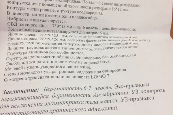 Кракен сайт пишет пользователь не найден